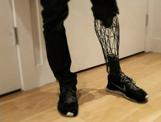 Протез ноги расспечатан на 3D принтере